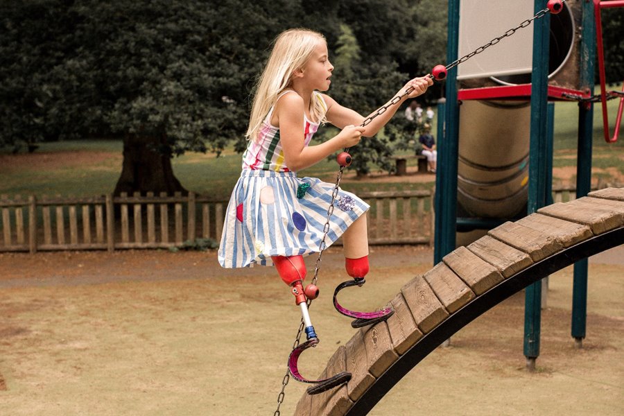 Girl with prosthetic legs playing on playground.